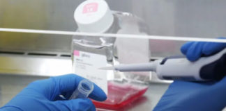 Ani Španija isi štar milja sastipnaske bukarne astarime tar Corona virus..