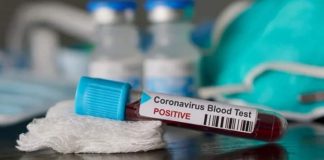 Bajrovela o numero tar o astarime pozitivna ko Covid 19 ..